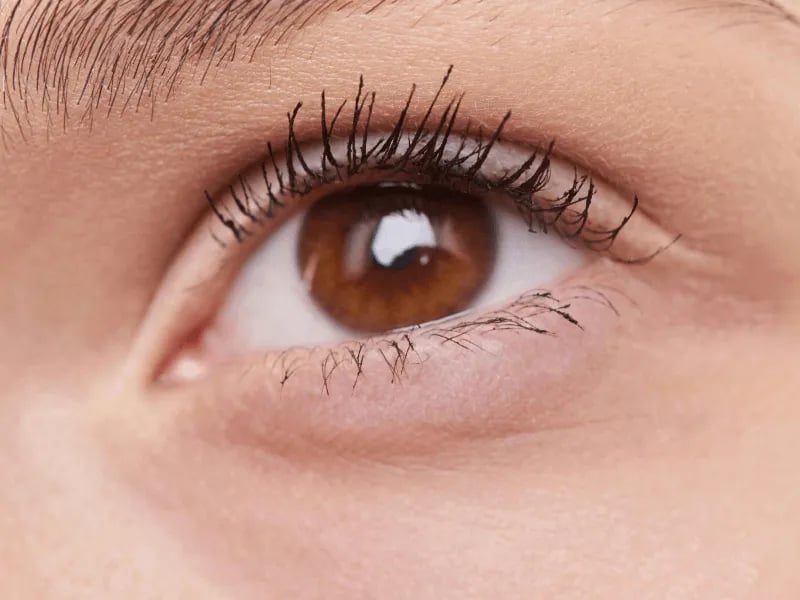 Blepharoplasty
