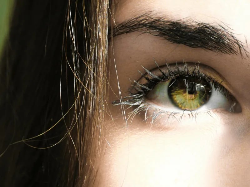 Blepharoplasty