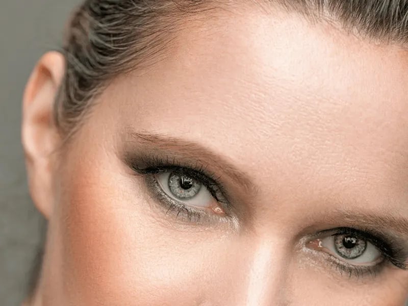 Blepharoplasty