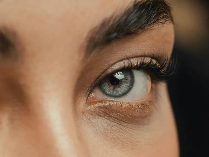 Blepharoplasty