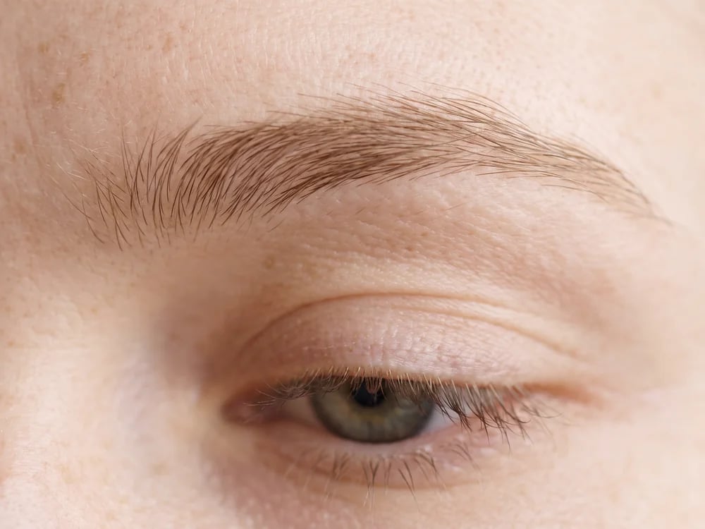 Eyebrow Transplant in Beverly Hills: Which Brow Problem Do You Actually Have?