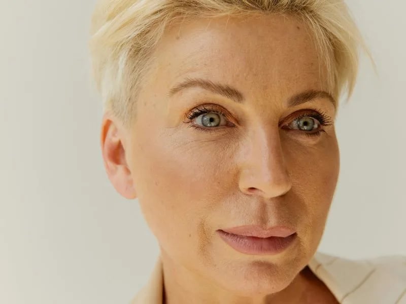 Lower Blepharoplasty