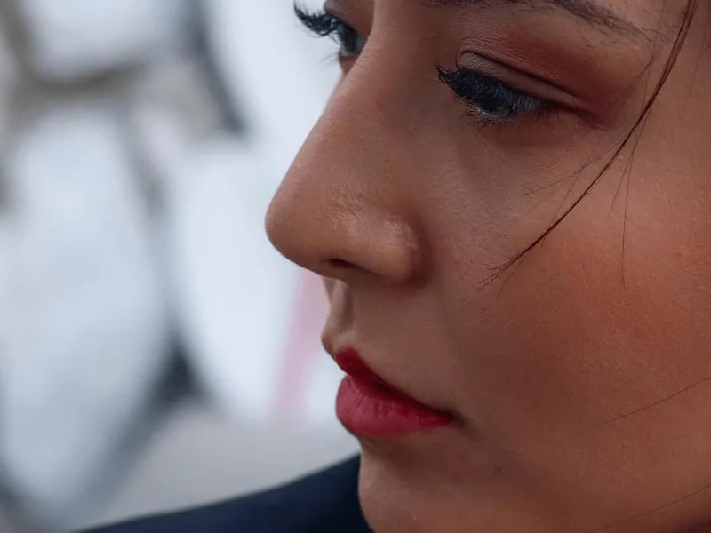Every Type of Facelift, Explained