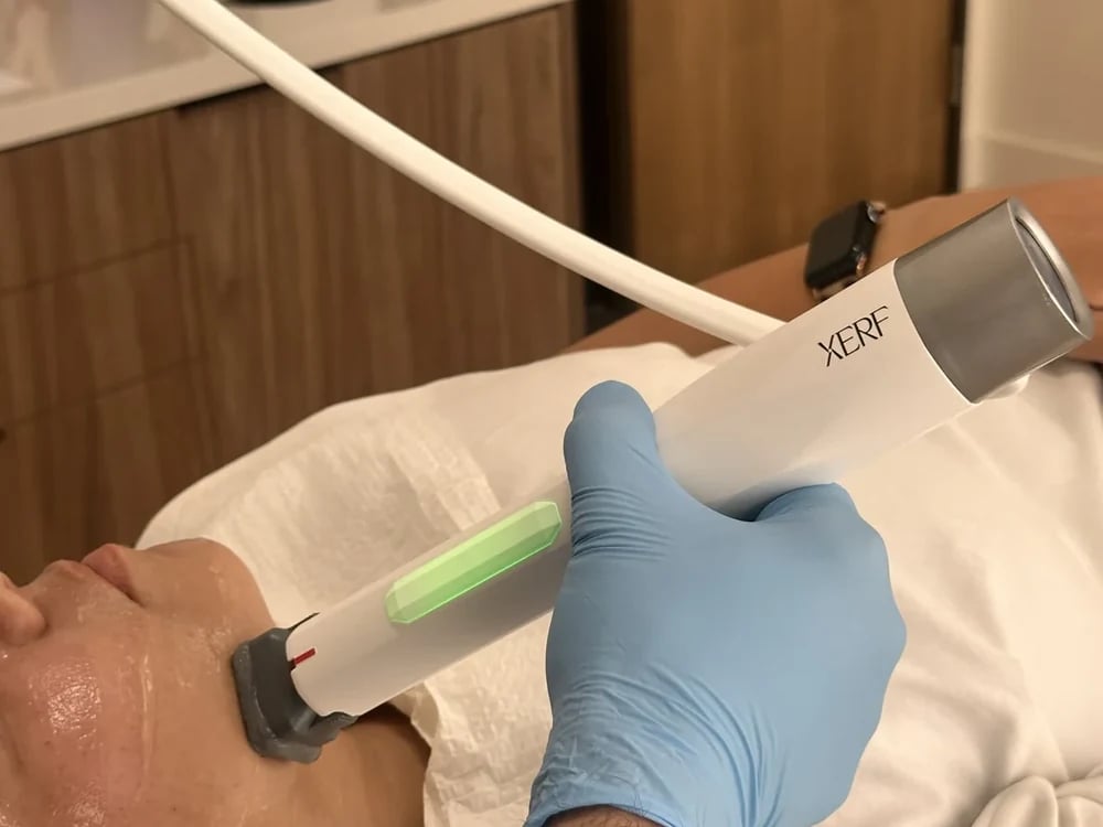 What Is XERF™ Treatment