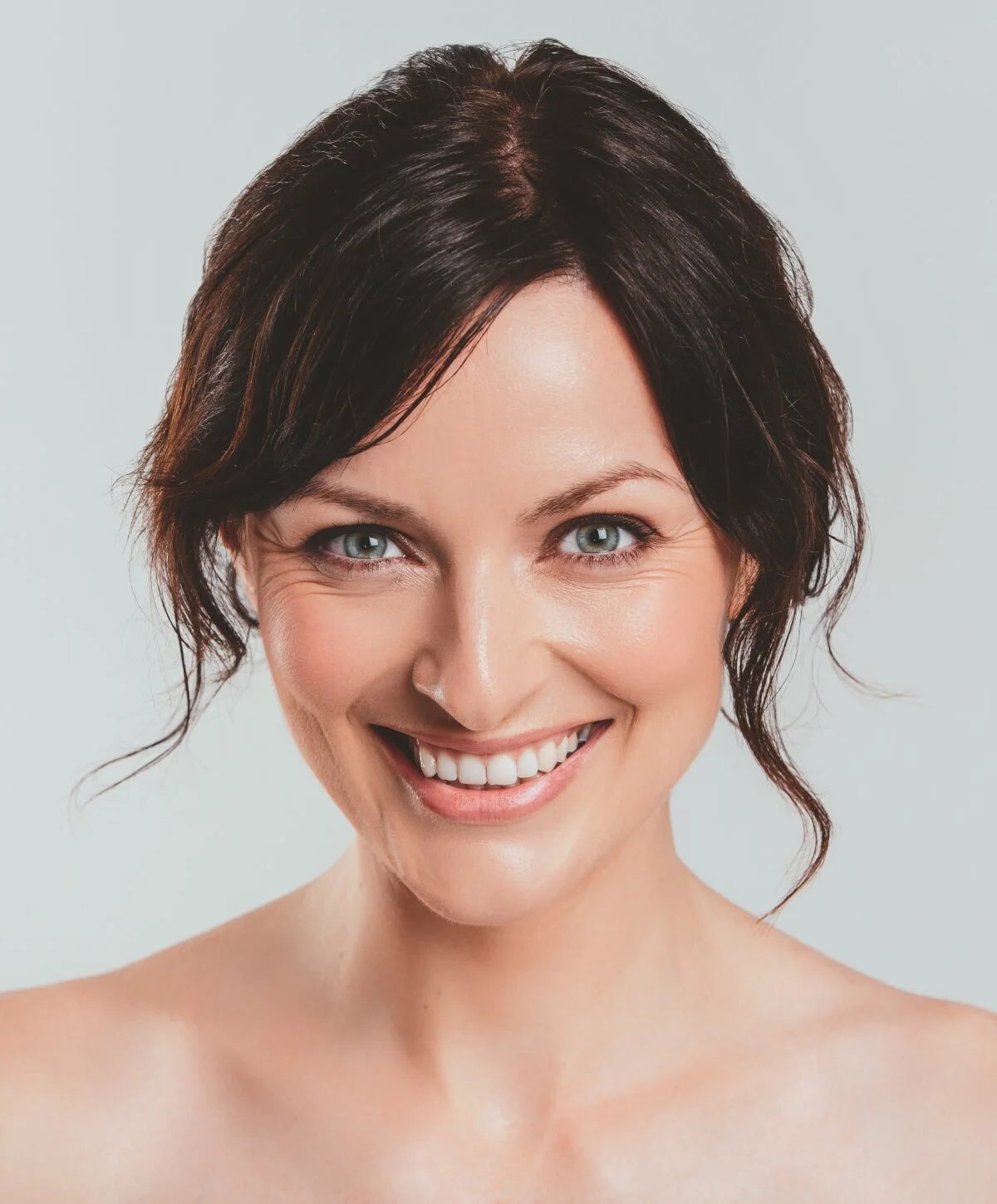 Holiday Neck Lift result at Harris Facial Plastic Surgery Beverly Hills