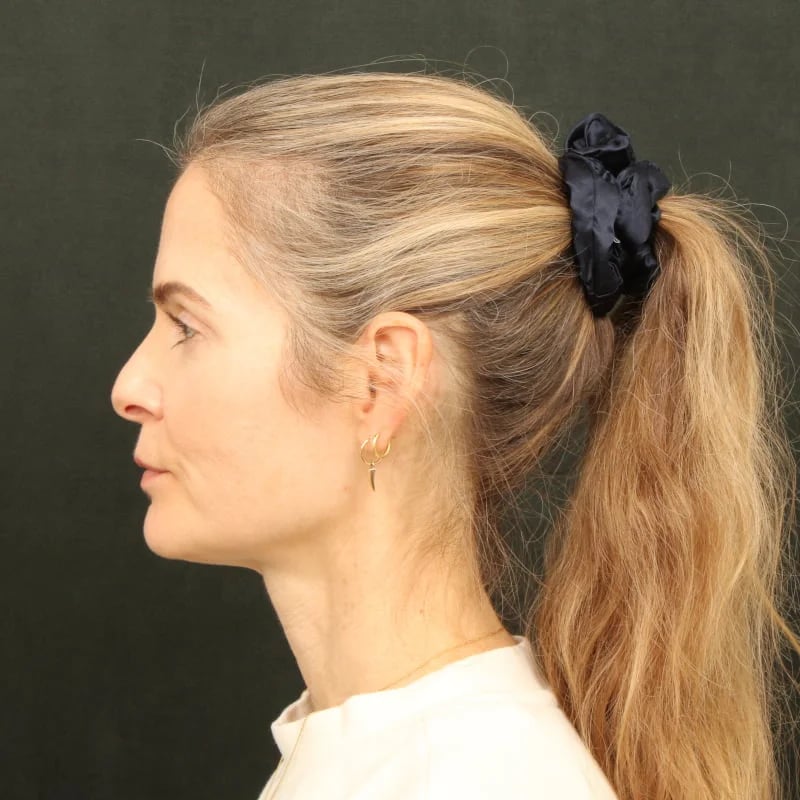 Deep Plane Facelift & Neck Lift Before & After Image