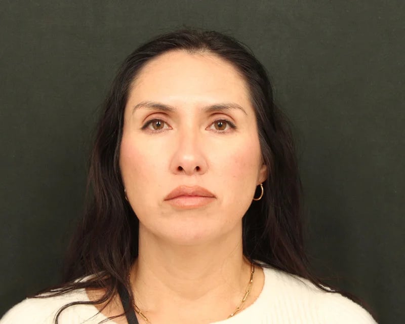 Patient Before Photo